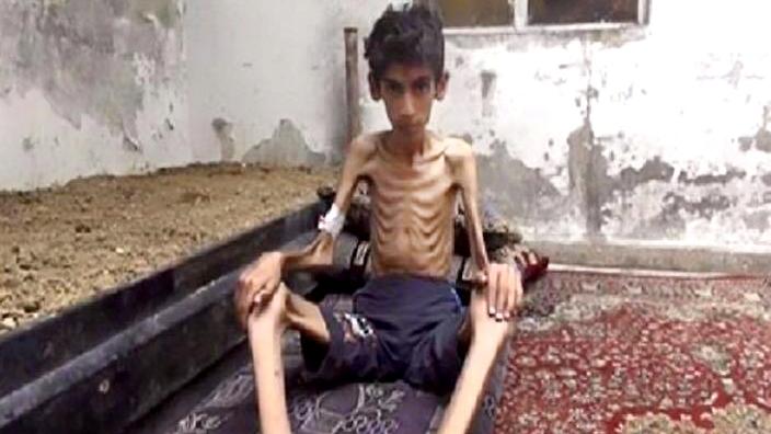 Syria: Magaalooyin Afar Ah Oo La Daad Gureyn Doono Dadka Ku Nool
